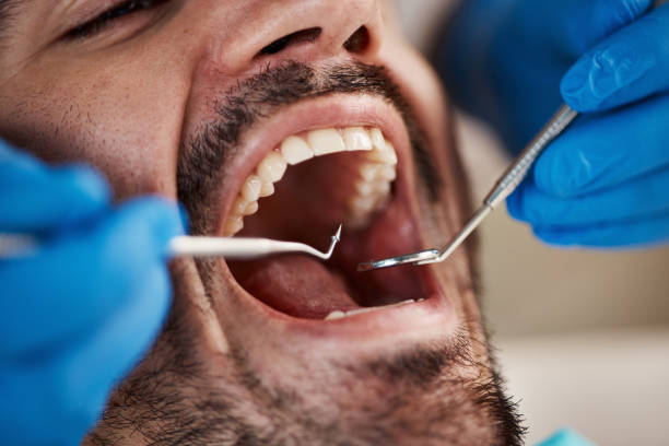 Best Emergency Gum Treatment in Madisonville, LA